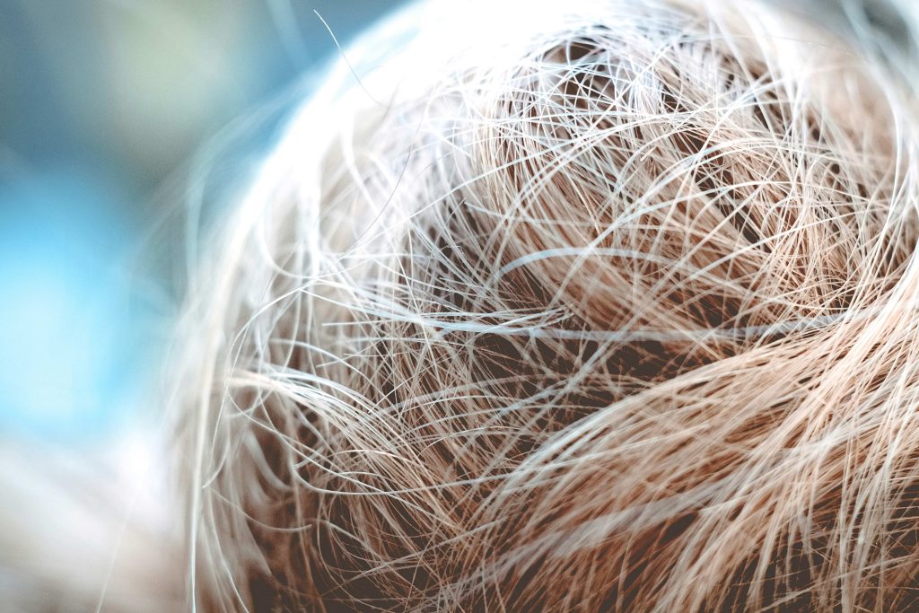 picture of a woman's hair who is suffering from hair loss related to PCOS or polycystic ovarian syndrome.