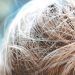 close up picture of hair when pcos causes hair loss