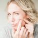 pcos acne on the chin, jawline, and cheeks, cystic acne, hormonal acne